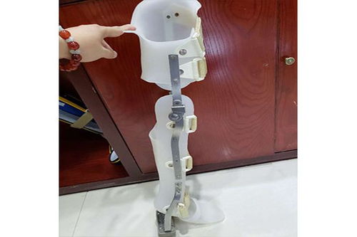 假肢與矯形器的使用周期與更換指南 科學(xué)維護(hù)，保障生活品質(zhì)